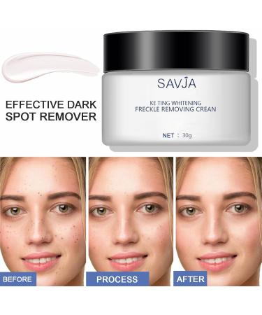 Freckle Removal Cream Dark Spot Remover for Face with Sodium Hyaluronate & Nicotinamide Spot Cream Sun Spots and Melasma Freckle Remover Dark Spot Corrector Cream Brighten Skin Tone - Buy Online on GoSupps.com