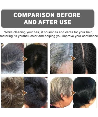 JIAOY Gray hair compacting bar soap gray hair inverted bar soap for men and women black soap for gray hair natural ingredients shampoo hair moisture and humidity 5 pieces 5 pieces - Buy Online on GoSupps.com