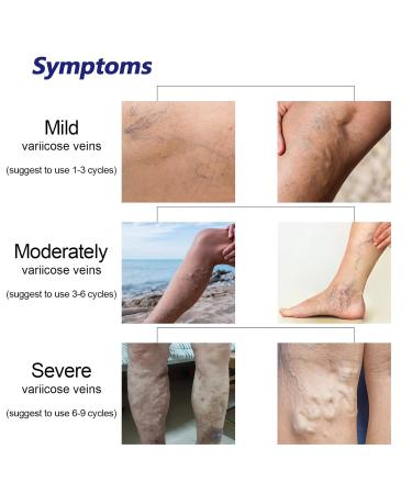 Pawmi Leg Care Spray Relieve Skin Discomfort for Legs - Buy Online on GoSupps.com