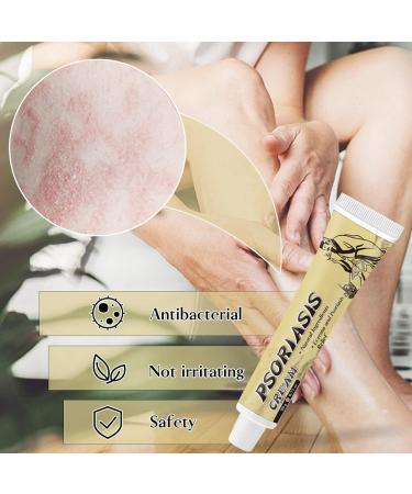 Natural Face & Body Moisturizing Cream for Dry Skin | Psoriasis Healing & Rash Relief | 20g - Buy Online on GoSupps.com