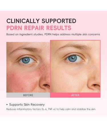 PDRN & Centella Face Serum 5000ppm Salmon PDRN & CICA Facial Serum with Niacinamide & Vitamin C Silky Hydrating Serum to Support Barrier Smooth Texture & Boost Radiance For All Skin Types 17 ml - Buy Online on GoSupps.com
