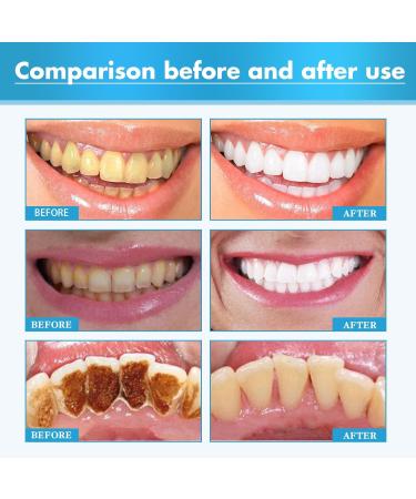 Ultimate Oral Care Set: Toothbrush Mouthwash Whitening Foam & Tartar Remover for a Healthier Smile - Buy Online on GoSupps.com