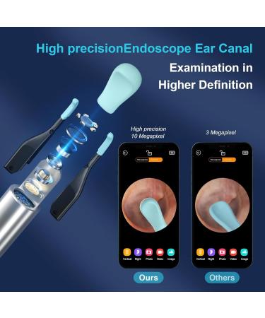 Buy BEBIRD Ear Wax Removal Tool with Camera - 10MP Ear Cleaner Kit for iOS & Android | Efficient Ear Wax Removal - Buy Online on GoSupps.com