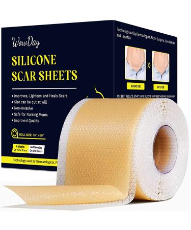 Silicone Scar Sheets - (1.6 x 60- 3M) Medical Grade Silicone Scar Removal Tape - Professional Silicon Scar Treatment Strips for Scar Healing C-Section Surgery Burn Keloid 1.6x60 Inch (Pack of 1)