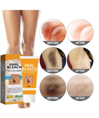 BEROZA 2PCS Crema Aclaradora Crema Reparadora Para Manchas Oscuras 50ml Adecuado para varias reas como cara axilas cuello zona privada - Buy Online on GoSupps.com