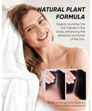 Pumpkin Seed Oil Capsules | 300 Softgels Pumpkin Seed Oil 2 in 1 with Saw Palmetto | Hair Growth&Shedding Reduction | Plant-Based Formula for Hormonal Balance, Bladder Comfort & Restful Sleep - Buy Online on GoSupps.com
