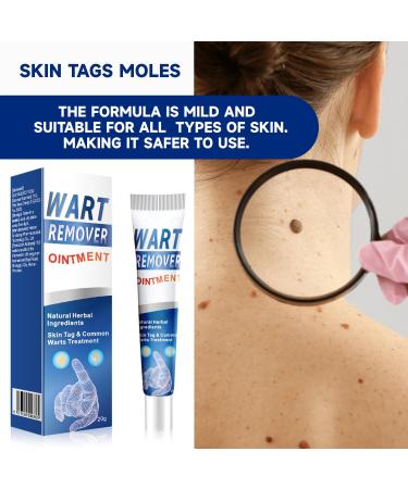  MagiSel Resistant Warts for Hands & Feet Anti-Wart and Anti-Stain Cream Anti-Wart Moisturizing Cream Anti-Corn Foot Descaling Wart Remover for Hands and Feet 20g - Buy Online on GoSupps.com