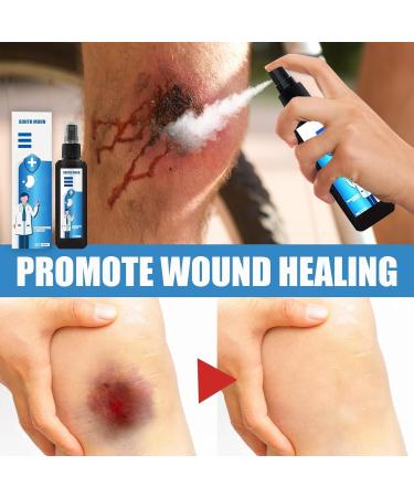 Sodium Chlorite Spray Wound 100ml - Family Health Product for Inflammation - Skin-Friendly Formula - White - Buy Online on GoSupps.com