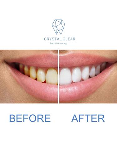 Teeth Whitening Gel Refill 35% Carbamide Peroxide - 5 Pack | No Sensitivity Fast & Effective | USA Dentist Recommended - Buy Online on GoSupps.com