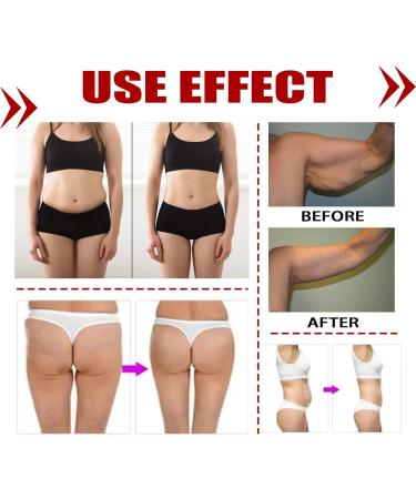 Demeras Lymphatic Dredging Patch - 3 Boxes, Self Adhesive, Armpit Lymph Care - Promotes Drainage and Wellness - Buy Online on GoSupps.com