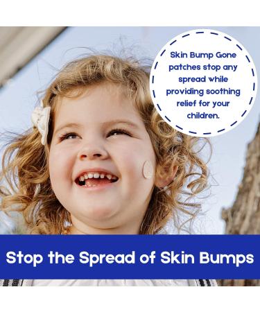 Hydrogel Skin Patches - Smooth Bumps & Hydrate | Dermatologist-Invented | 48 Patches for International Shipping - Buy Online on GoSupps.com