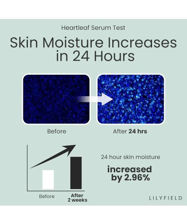 LILYFIELD Advanced Calming Serum | Heartleaf Korean Skincare for Sensitive Skin | Soothes & Nourishes | 30ml - Buy Online on GoSupps.com
