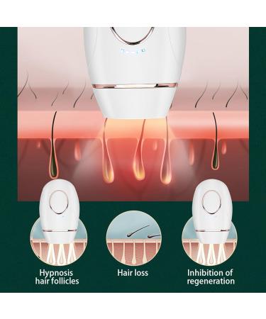 IPL Hair Removal Device - Painless Mini Body Epilator for Legs & Body with White Control Light (EU Connector) - Shop Internationally - Buy Online on GoSupps.com