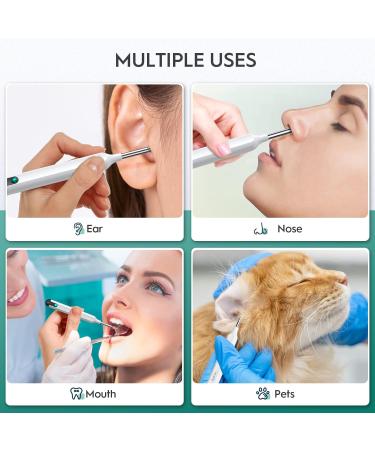 Oxbird 1080P Wireless Ear Wax Removal Kit with Camera - Smart Ear Cleaner for iPhone, iPad & Android - Black - Buy Online on GoSupps.com
