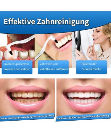 Professional Tartar Remover 4-Pack | Effective Teeth Whitening & Stain Removal Tool for a Bright Smile - Buy Online on GoSupps.com