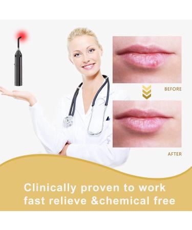 2023 Newest Red Light Therapy Device for Cold Sore & Canker Sore Treatment - Infrared Light Therapy for Pain Relief in Lips  Mouth  Nose  Ear  Knee  Feet  Hands - Removable Tip - Buy Online on GoSupps.com