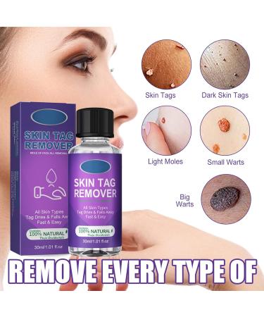 Skin Tag & Mole Removal Set - Natural Wart Remover & Corrector (3PCS) - Buy Online on GoSupps.com