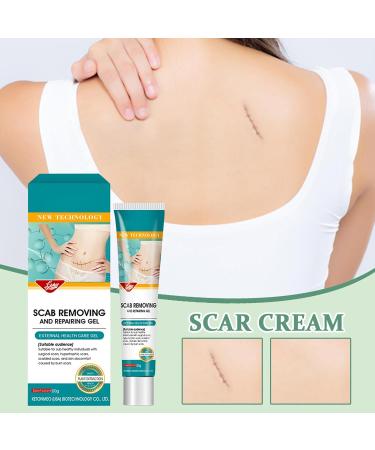 Scar Cream - 20g Soothing - Advanced Repair Cream for Scars For Comfort Recovery Burn Protection Domestic Body Injury - Buy Online on GoSupps.com