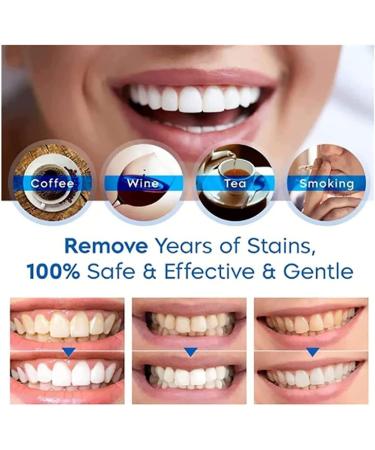 Buy Tlopa Ampoule Toothpaste - Stain Remover & Tartar Control (3/5 Boxes) | 3V Fruit Acid Tooth Elevation | International Shipping Available - Buy Online on GoSupps.com