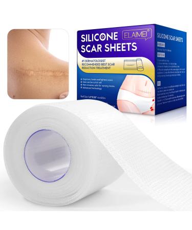 Clear Gel Silicone Scar Tape(1.6'' x 120'') Silicone Scar Sheets Silicone Scar Strips Scar Removal Silicone Tape  Scar Tape for C-Section Surgery Scar  Keloid  Burn  Acne
