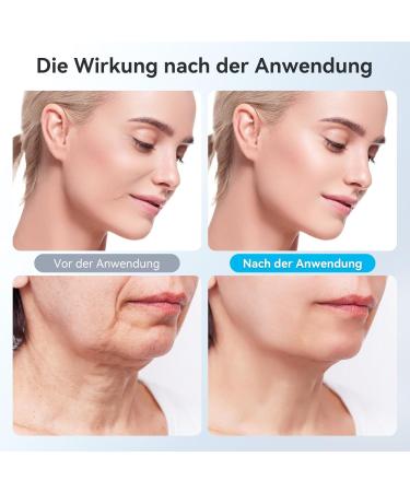 Carer Spark 4-in-1 Facial Massage Device - Anti-Aging RF EMS & LED Technology for Wrinkle Reduction & Skin Tightening - Buy Online on GoSupps.com