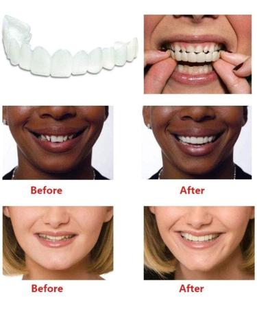 Brigtviee Cosmetic Teeth Veneers - 2 Pairs Temporary Prostheses for Upper & Lower Dental Comfort Fit - Buy Online on GoSupps.com