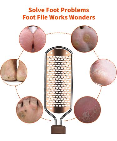 Foot File Professional Pedicure Stainless Steel Detachable Foot Scrubber Callus Remover for feet Foot Scraper Corns Callous Hard Skin Removers Pedicure Rasp for Wet and Dry Feet(Golden) - Buy Online on GoSupps.com