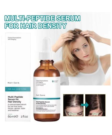 The Ordinary Multi-Peptide Hair Density Serum 60ml | Vegan Hair Growth Serum for Men & Women | Boost Hair Volume & Density - Buy Online on GoSupps.com