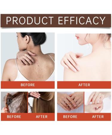 HLMULL Pumpkin Seed Oil Organic Pumpkin Seed Oil Pumpkin Essential Oil 100% Pure & Natural Cold Pressed for Scalp Skin & Hair - Buy Online on GoSupps.com