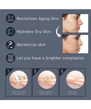 NOAMED Snail Mucin 92% Repair Cream 3.52 oz - Daily Collagen Face Moisturizer - Reduce Wrinkles - Korean Skincare - 1PCS, 3.52 Fl Oz - Buy Online on GoSupps.com