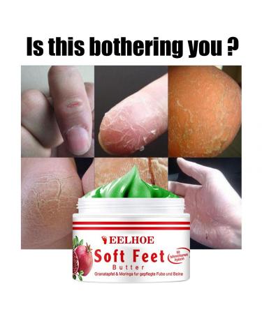 Intensive Regenerating Foot Cream - Ultimate Foot Care Balm for Dry Feet & Cracked Heels - 1g | Soothing Relief for All Skin Types - Buy Online on GoSupps.com