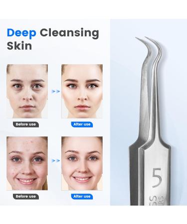 Kosimai Visual Black Head Remover for Face Tool with Camera HD Camera 20 times magnification 1080P Suitable for Women and Men Pore Cleaner (Silver) - Buy Online on GoSupps.com