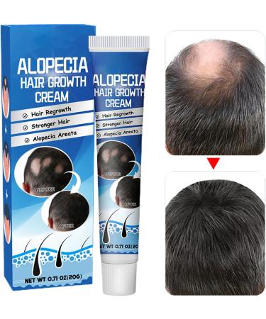  Generisch Areata Anti-Alopecia Cream - Repairing Cream for Hair Regrowth with Sophora Flavescens | Scalp Treatment for Baldness and High Hairline | Natural Formula - Buy Online on GoSupps.com