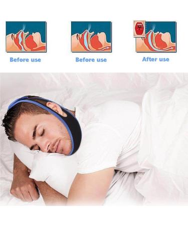 3PCS Anti-Snoring Chin Straps for Men and Women - Adjustable Comfortable Snore Reduction Devices for Better Sleep - Buy Online on GoSupps.com