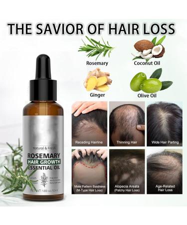 Rosemary Oil for Hair Hair Growth Oil Hair Rosemary Oil Relieve Dry Damaged Hair to Target Hair Loss Rosemary Hair Serum for Hair Rapid Growth and Thickening Trengthen Hair Roots - Buy Online on GoSupps.com