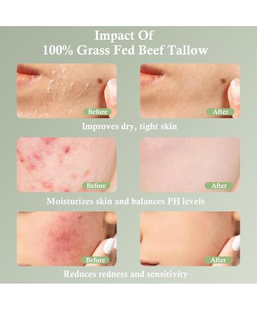 100% Organic Beef Tallow Face Moisturizer | Unscented Whipped Tallow Cream for Sensitive Skin | Grass-Fed | Nourishing Skin Care - Buy Online on GoSupps.com