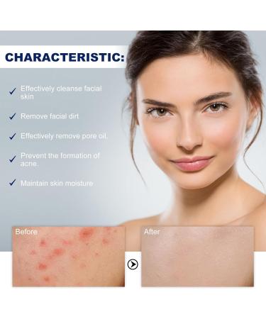  Luthasolic Akne Clean Foam Cleanser 170 g Acne Foaming Wash Akne Gentle Facial Cleansing Foam Deep Pore Cleansing Foam for Facial Cleansing Against Makeup Dirt (4%) - Buy Online on GoSupps.com