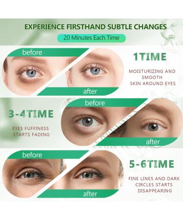 Green Gold Collagen Under Eye Mask (60 Pcs) - Hydrating Gel Pads for Dark Circles, Puffiness & Wrinkles - 30 Pairs Under Eye Patches for Men & Women - Beauty Skin Care Treatment - Buy Online on GoSupps.com