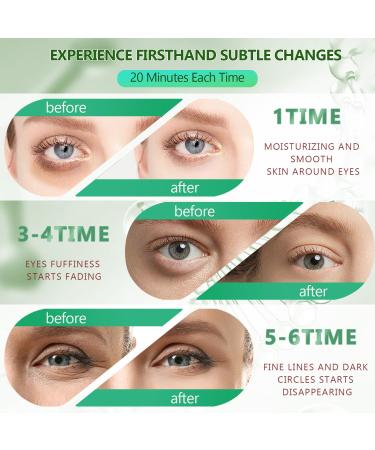 2 Packs Under Eye Patches - 60 Pcs Collagen Gel Pads for Puffiness & Dark Circles - Hydrating 30 Pairs Eye Masks for Women & Men - Buy Online on GoSupps.com