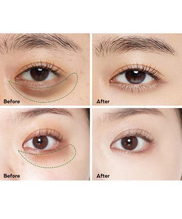 Feeke Magic Eye Cream - Anti Aging Treatment for Under Eye Bags, Wrinkles, Puffiness, Dark Circles & Fine Lines - 1PC - Buy Online on GoSupps.com
