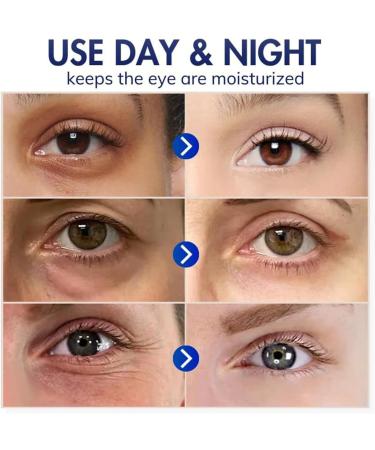  EXQST Dobshow Advanced Eye Cream Fast Wrinkle Repair Eye Contour Cream Eliminates Eye Puffiness/Dark Circles/Eye Wrinkles - Buy Online on GoSupps.com