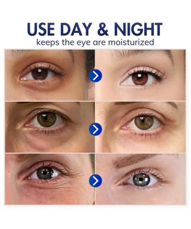 Exqst DobShow Advanced Eye Cream - Fast Wrinkle Repair for Dark Circles Tear Bags & Eye Folds | Shop Internationally - Buy Online on GoSupps.com