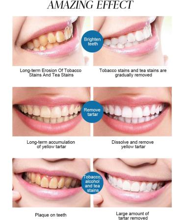 Super Whitening Coconut Papaya Menthol Toothpaste - Strengthens Sensitive Teeth & Enamel - Fast Cleaning 100g | International Shipping - Buy Online on GoSupps.com