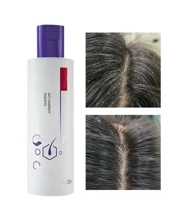 WJnflQN Deep Cleansing Shampoo 205ml Moisturizing Conditioner for Men Balancing Shampoo for Oily Scalp - For Hair Care Travel Home Family and Friends