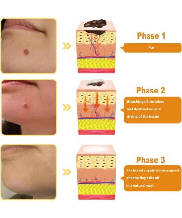 2pc Zoencgz New Bee Venom Repair Cream 60g Natural Hydrating Moisturizing Treatment Cream for Men&Women - Buy Online on GoSupps.com