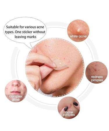 Hydrocolloid Acne Patch - Large Spot Control Stickers for Body Cheek Forehead & Chin | 20 Plasters for Effective Acne Treatment - Buy Online on GoSupps.com