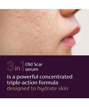 Mederma Scar Serum Triple-Action Formula with Vitamin E Hyaluronic Acid & Niacinamide Clinically Shown to Reduce Old Scars 1 Fl. Oz. - Buy Online on GoSupps.com