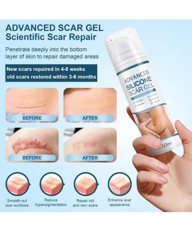 Advanced Scar Cream Silicone Scar Gel - White - 50ml - Buy Online on GoSupps.com