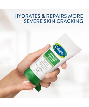 Cetaphil Cracked Skin Repair Balm 3 oz For Very Rough & Cracked Sensitive Skin Protects Soothes & Restores Deeper Cracks Hypoallergenic Fragrance Free (Packaging May Vary) 3 Ounce (Pack of 1) Cracked Skin 3oz - Buy Online on GoSupps.com