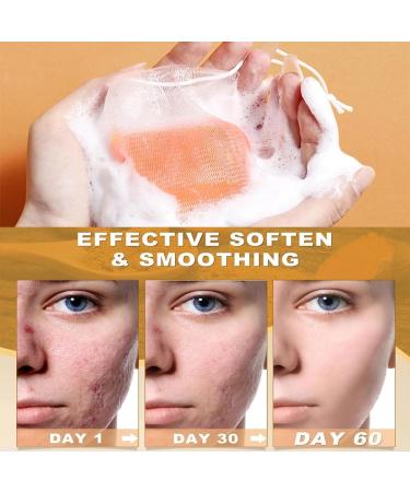 Turmeric Soap Bar Kojic Acid Soap Turmeric Soap Bar Turmeric Brightening Soap Turmeric Soap Bar for Face & Body Natural Turmeric Skin Soap Remove Acne Blackheads Dark Spot for Deep Cleansing - Buy Online on GoSupps.com